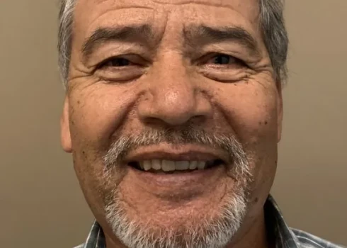 Isidro smiling after jaw tumor removal and reconstruction